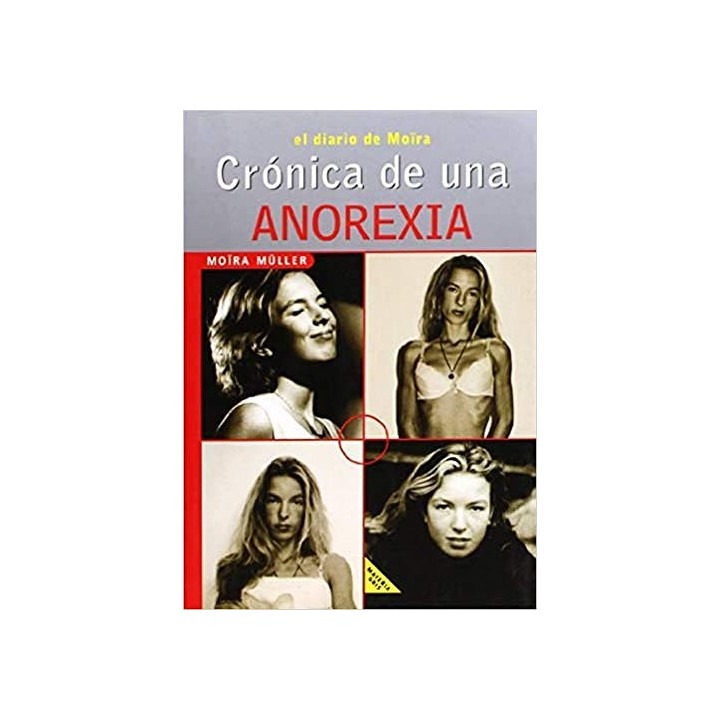 Crónica De Una Anorexia